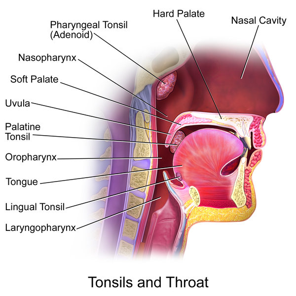 Tonsillitis